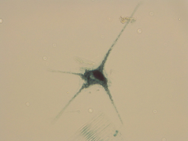 Ceratium Slides - Ceratium 08 400X